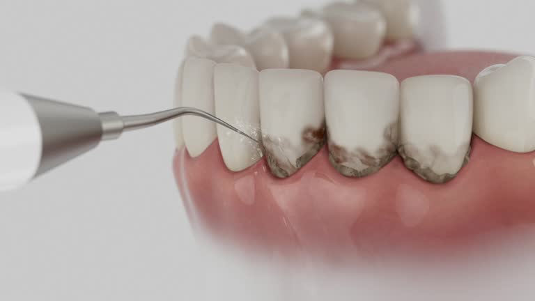 Trusted Root Canal Treatment service in Glade Spring, VA - Dentist Open Now